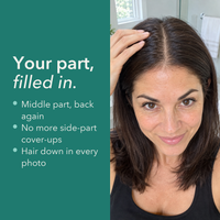 Evidente PDRN Scalp Shot