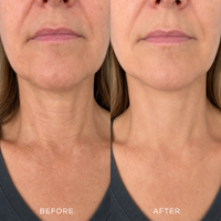 Visible Neck Lift Cream